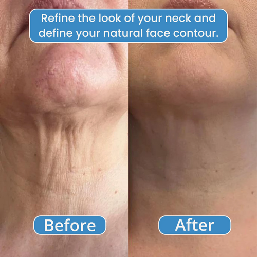 Avea OneSculpt™ face cupping machine
